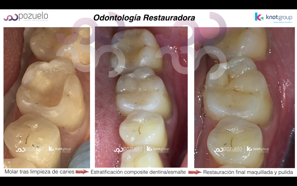 Odontología Restauradora y Estética